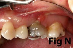 14may8srryoobearn 14may8srryoobearn