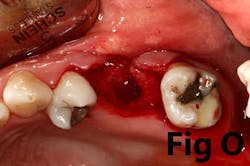 14may8srryoobearo 14may8srryoobearo