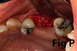 14may8srryoobearp 14may8srryoobearp