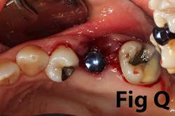 14may8srryoobearq 14may8srryoobearq