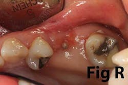 14may8srryoobearr 14may8srryoobearr