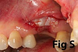 14may8srryoobears 14may8srryoobears