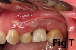 14may8srryoobeart 14may8srryoobeart