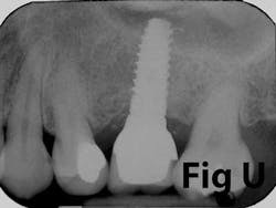14may8srryoobearu 14may8srryoobearu