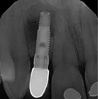 14nov06srrkephart02 14nov06srrkephart02