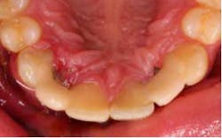 14nov06srrkephart04 14nov06srrkephart04