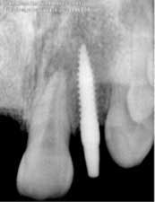 14nov20srrmann02 14nov20srrmann02