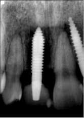 14nov20srrmann04a 14nov20srrmann04a