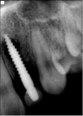 14nov20srrmann04b 14nov20srrmann04b