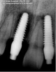 14nov20srrmann05 14nov20srrmann05