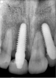 14nov20srrmann06 14nov20srrmann06