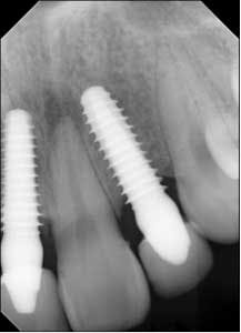 14nov20srrmann07 14nov20srrmann07