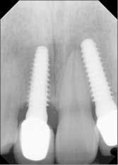 14nov20srrmann08a 14nov20srrmann08a