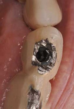 15apr9srrsalierno Rescue01 15apr9srrsalierno Rescue01