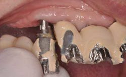 15apr9srrsalierno Rescue02 15apr9srrsalierno Rescue02