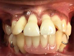 15aug20pia Gargiulo03 15aug20pia Gargiulo03