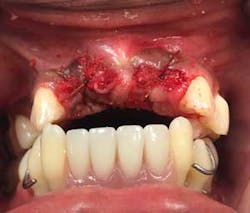 15aug20pia Gargiulo04 15aug20pia Gargiulo04