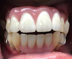 15aug20pia Gargiulo05 15aug20pia Gargiulo05