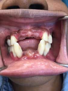 15aug20pia Gargiulo06 15aug20pia Gargiulo06