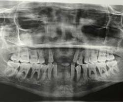 15aug20pia Gargiulo08 15aug20pia Gargiulo08