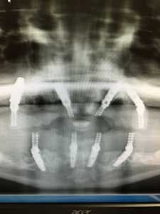 15aug20pia Gargiulo10 15aug20pia Gargiulo10