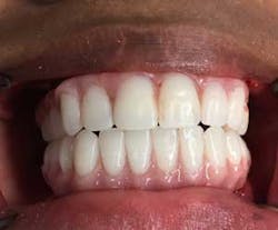 15aug20pia Gargiulo11 15aug20pia Gargiulo11