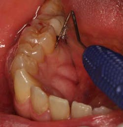 15mar26srrwingrove01 15mar26srrwingrove01