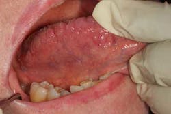 15may28srrfroum02 15may28srrfroum02