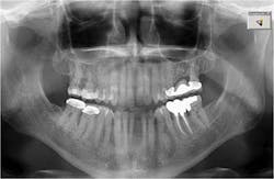 15may28srrpette01 15may28srrpette01