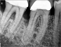 15may28srrpette02 15may28srrpette02