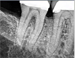 15may28srrpette04 15may28srrpette04