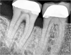 15may28srrpette05 15may28srrpette05