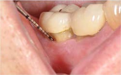 15may28srrpette06 15may28srrpette06