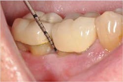 15may28srrpette07 15may28srrpette07