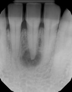 15oct15pia Clin Tip Froum01 15oct15pia Clin Tip Froum01