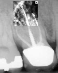 15oct15pia Mann09 15oct15pia Mann09