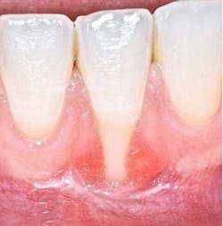 15padvjul16doobrow08 15padvjul16doobrow08