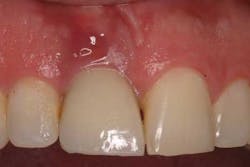 15sept17pia Clinicaltip Froum01 15sept17pia Clinicaltip Froum01