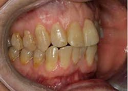 15sept17pia Curryroblee02 15sept17pia Curryroblee02