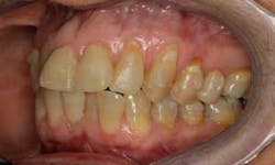 15sept17pia Curryroblee03 15sept17pia Curryroblee03