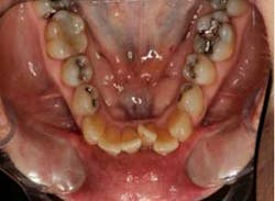 15sept17pia Curryroblee05 15sept17pia Curryroblee05