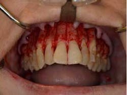 15sept17pia Curryroblee06 15sept17pia Curryroblee06