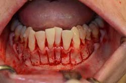 15sept17pia Curryroblee06a 15sept17pia Curryroblee06a