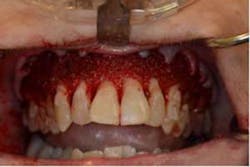 15sept17pia Curryroblee07 15sept17pia Curryroblee07