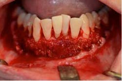 15sept17pia Curryroblee10 15sept17pia Curryroblee10