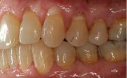 15sept17pia Curryroblee13 15sept17pia Curryroblee13