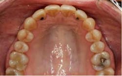 15sept17pia Curryroblee14 15sept17pia Curryroblee14