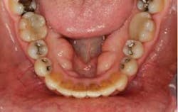 15sept17pia Curryroblee15 15sept17pia Curryroblee15