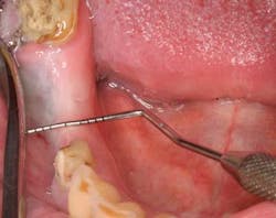 15srrfeb26froumsocketbone01 15srrfeb26froumsocketbone01