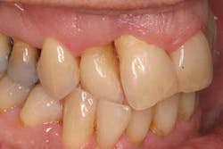 15srrfeb26froumsocketbone02 15srrfeb26froumsocketbone02